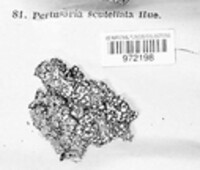 Pertusaria albescens var. albescens image